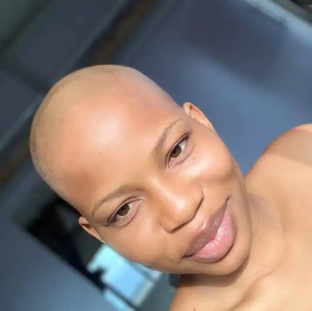 Bald glow